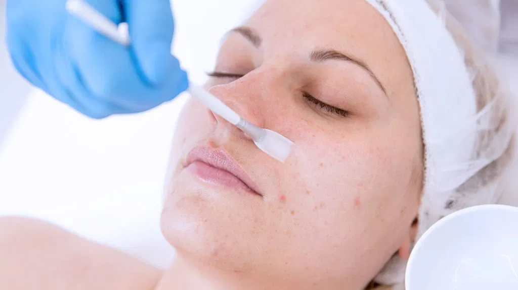 What Benefits Do Chemical Peels Bring With Them?