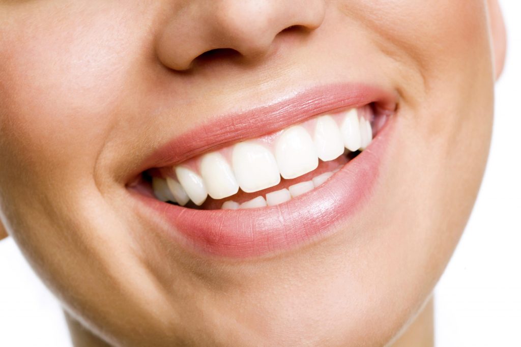 Teeth Whitening: Getting the Brightest Smile You Have Dreamed of in Sterling Heights