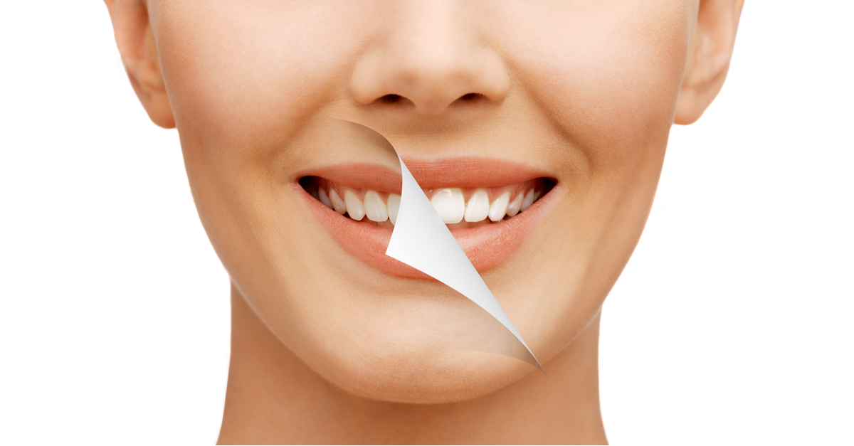 What are the Main Causes of Tooth Discoloration?