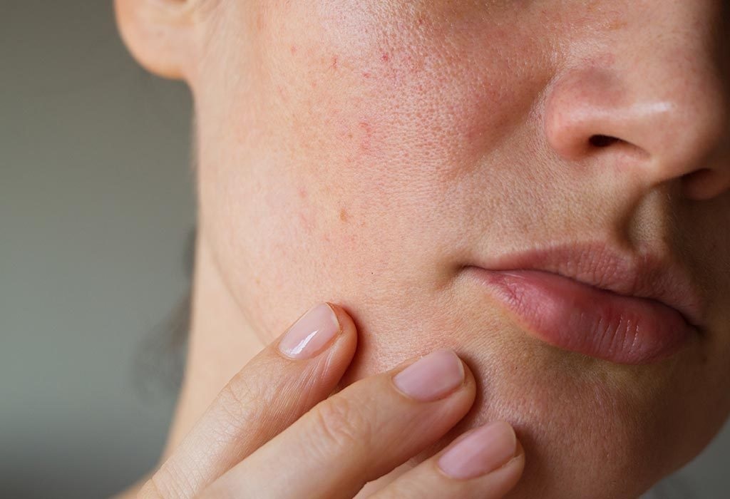 Minimize Pores for Smoother Skin: Effective Reduction Techniques