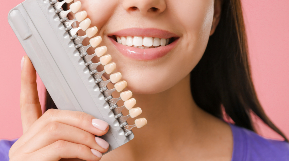 The Importance of Choosing the Right Dentist for Veneers